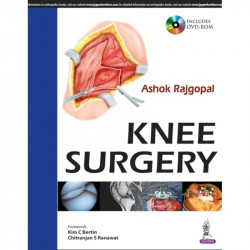 KNEE SURGERY INCLUDES DVD-ROM book by Rajgopal Ashok - Back Cover