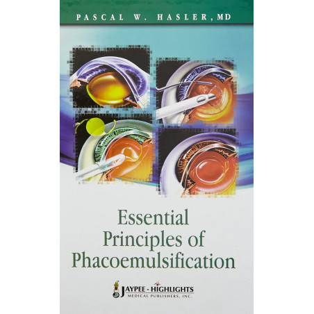 Essential Principles of Phacoemulsification book by Hasler