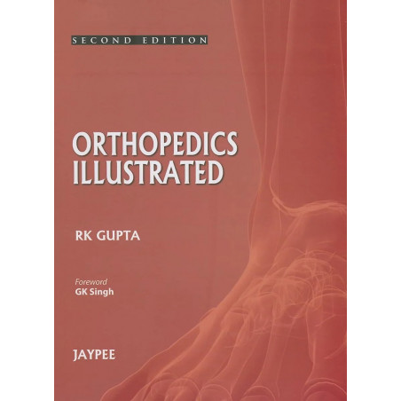 ORTHOPEDICS ILLUSTRATED book by Gupta Rk