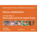 Single Surgical Procedures in Obstetrics and Gynaecology–34: Fistula Operations-A Colour Atlas of Rectovaginal and Vesicovag…