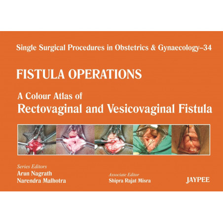 Single Surgical Procedures in Obstetrics and Gynaecology–34: Fistula Operations-A Colour Atlas of Rectovaginal and Vesicovag…