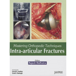 Mastering Orthopedic Techniques Intra-articular Fractures book by Malhotra Rajesh