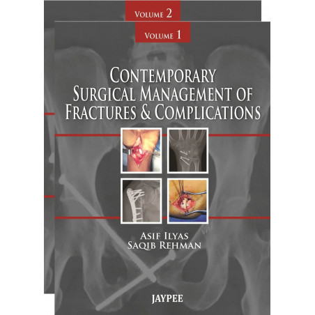 Contemporary Surgical Management of Fractures & Complications (2 Vols): Pelvis and Lower Extremity book by Rehman Ilyas