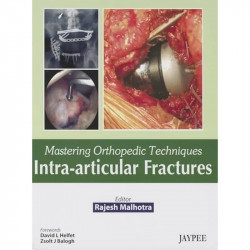 Mastering Orthopedic Techniques Intra-articular Fractures book by Malhotra Rajesh - Back Cover