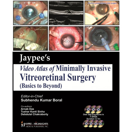 Jaypee Video Atlas Of Minimally Invasive Vitreoretinal Surgery book by Boral