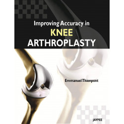 IMPROVING ACCURACY IN KNEE ARTHROPLASTY book by Paulraj Seenidurai
