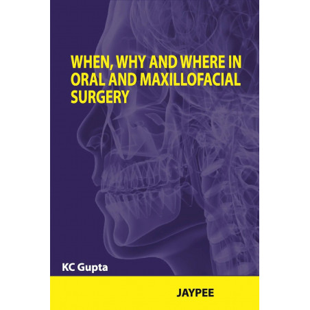WHEN,WHY AND WHERE IN ORAL AND MAXILLOFACIAL SURGERY book by Gupta Kc