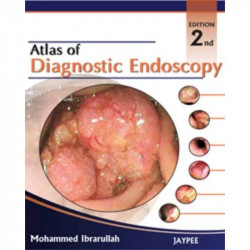 Atlas of Diagnostic Endoscopy book by Ibrarullah