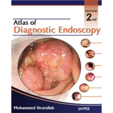 Atlas of Diagnostic Endoscopy book by Ibrarullah