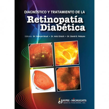 Diagnóstico y Tratamiento de la Retinopatía Diabética book by MD Samuel Boyd