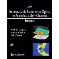 Atlas – Tomografía de Coherencia Óptica en Patología Macular y Glaucoma book by Vishali Gupta, Amod Gupta