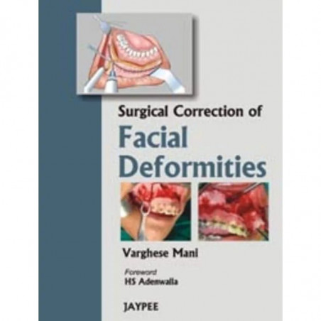 Surgical Correction of Facial Deformities book by Mani, Varghese Mani