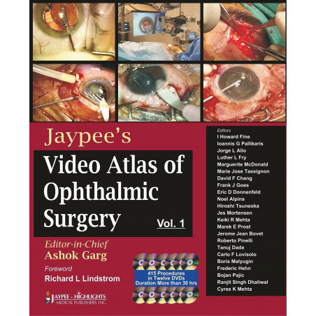 Mastery Of Holcomb C3-R Crosslinking For Keratoconus And Other Disorders:For Patients & Phy: Volume I (12 DVD-ROMs) book by…