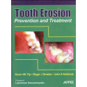 TOOTH EROSION PREVENTION AND TREATMENT book by Yip