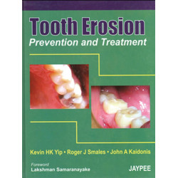 TOOTH EROSION PREVENTION AND TREATMENT book by Yip