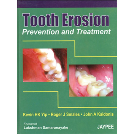 TOOTH EROSION PREVENTION AND TREATMENT book by Yip