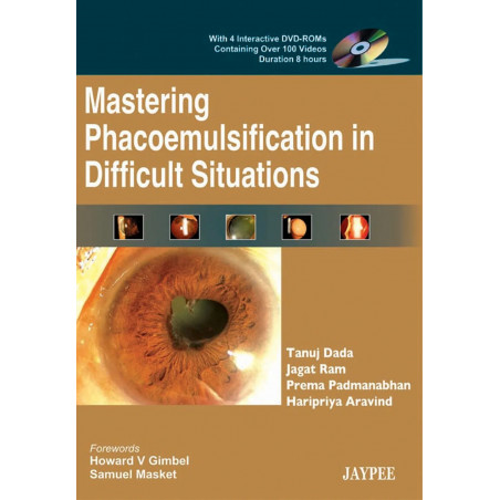 MASTERING PHACOEMULSIFICATION IN DIFF.SITUATIONS WITH 4 INTER.DVD-ROMS CONT.OVER 100 VIDEOS book by Dada