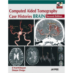 Computed Aided Tomography Case Histories: BRAIN with CD-ROM book by Karthikeyan
