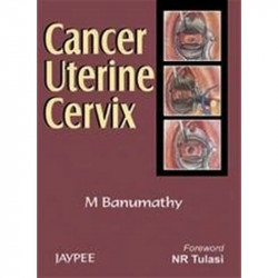 Cancer Uterine Cervix book by Banumathy