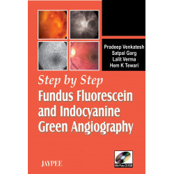 Step By Step Fundus Fluorescein And Indocyanine Green Angiography With Photo Cd Rom book by Venkatesh