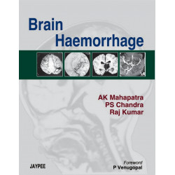 Brain Haemorrhage book by Mahapatra