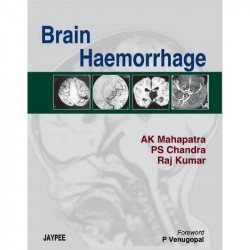 Brain Haemorrhage book by Mahapatra - Back Cover