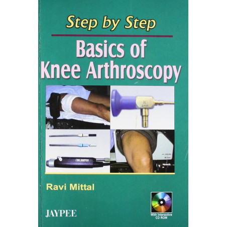 Step by Step Basics of Knee Arthroscopy (with CD ROM) book by Mittal
