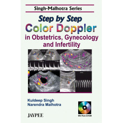 Step by Step Color Doppler in Obstetrics, Gynecology and Infertility (with CD Rom) (Singh - Malhotra Series) book by Kuldeep…