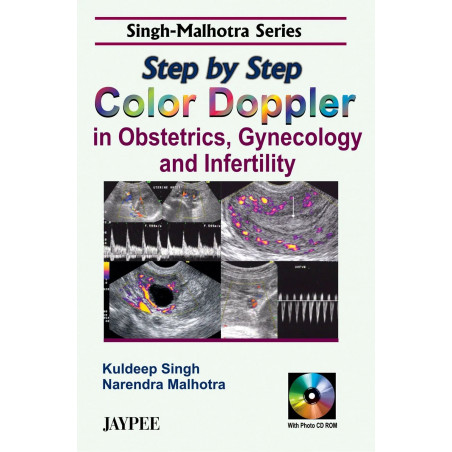 Step by Step Color Doppler in Obstetrics, Gynecology and Infertility (with CD Rom) (Singh - Malhotra Series) book by Kuldeep…