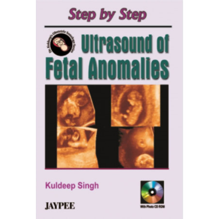 Step by Step Ultrasound of Fetal Anomalies (with Photo CD Rom) book by Kuldeep Singh