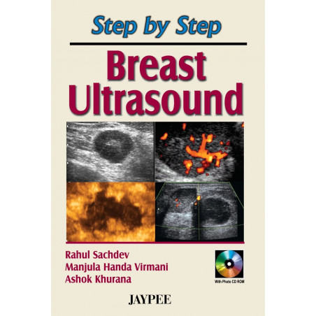 Step by Step Breast Ultrasound with Photo CD ROM book by Sachdev