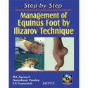 Step by Step Management of Equinus Foot by Ilizarov Technique with Interactive CD-ROM book by Agrawal