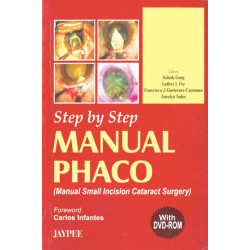 Step By Step Manual Phaco With Dvd-Rom book by Garg