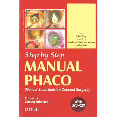 Step By Step Manual Phaco With Dvd-Rom book by Garg