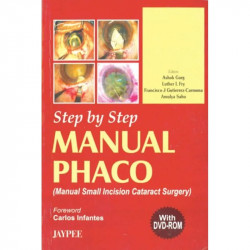 Step By Step Manual Phaco With Dvd-Rom book by Garg - Back Cover