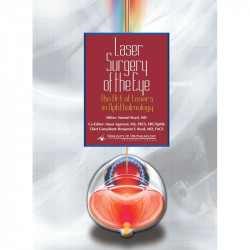 Laser Surgery of the Eye: The Art of Lasers in Ophthalmology(with CD-ROM) book by Boyd S.