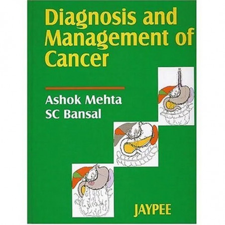 Diagnosis and Management of Cancer book by Ashok Mehta, S.C. Bansal