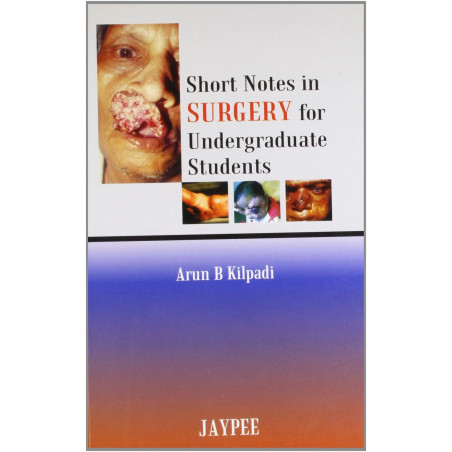 SHORT NOTES IN SURGERY FOR UNDERGRADUATE STUDENTS book by Kilpadi