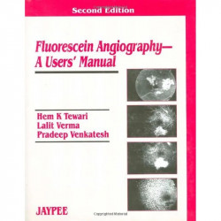Fluorescein Angiography: A Users' Manual book by Hem K. Tewari, Lalit Verma