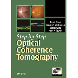 Step by Step Optical Coherence Tomography(with Photo CD-ROM) book by Sony