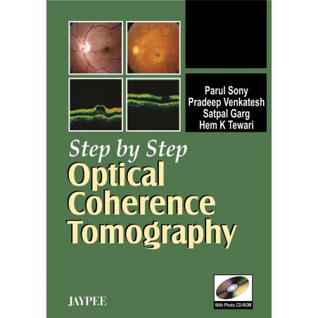 Step by Step Optical Coherence Tomography(with Photo CD-ROM) book by Sony
