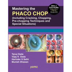 Mastering the Nucleotomy Techniques in Phaco (with 4 DVD-ROMs) (POD) book by Dada