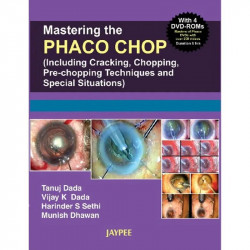 Mastering the Nucleotomy Techniques in Phaco (with 4 DVD-ROMs) (POD) book by Dada - Back Cover