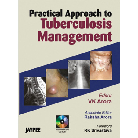 Practical Approach to Tuberculosis Management with CD-ROM book by Arora