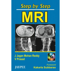 Step By Step Mri With Cd-Rom book by Reddy