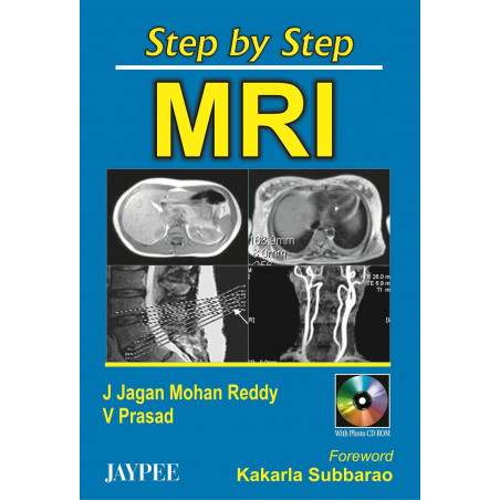 Step By Step Mri With Cd-Rom book by Reddy