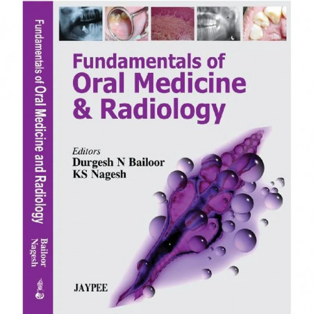FUNDAMENTALS OF ORAL MEDICINE & RADIOLOGY book by Bailoor