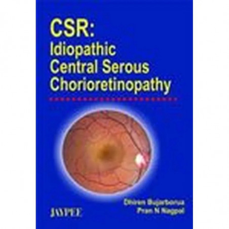 Csr Idiopathic Central Serous Chorioretinopathy book by Bujarborua