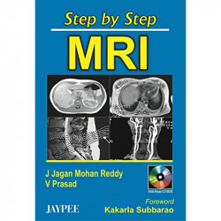 Step By Step Mri With Cd-Rom book by Reddy - Back Cover