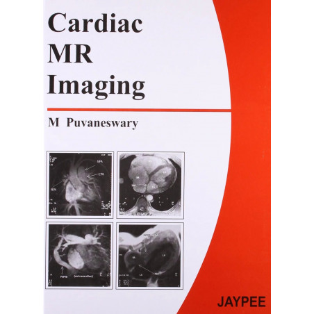 Cardiac Mr Imaging book by Puvaneswary